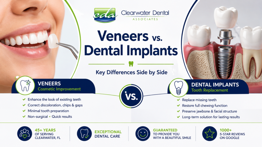 Clearwater Dental Associates feature image comparing veneers vs. dental implants for cosmetic improvement and missing tooth replacement.