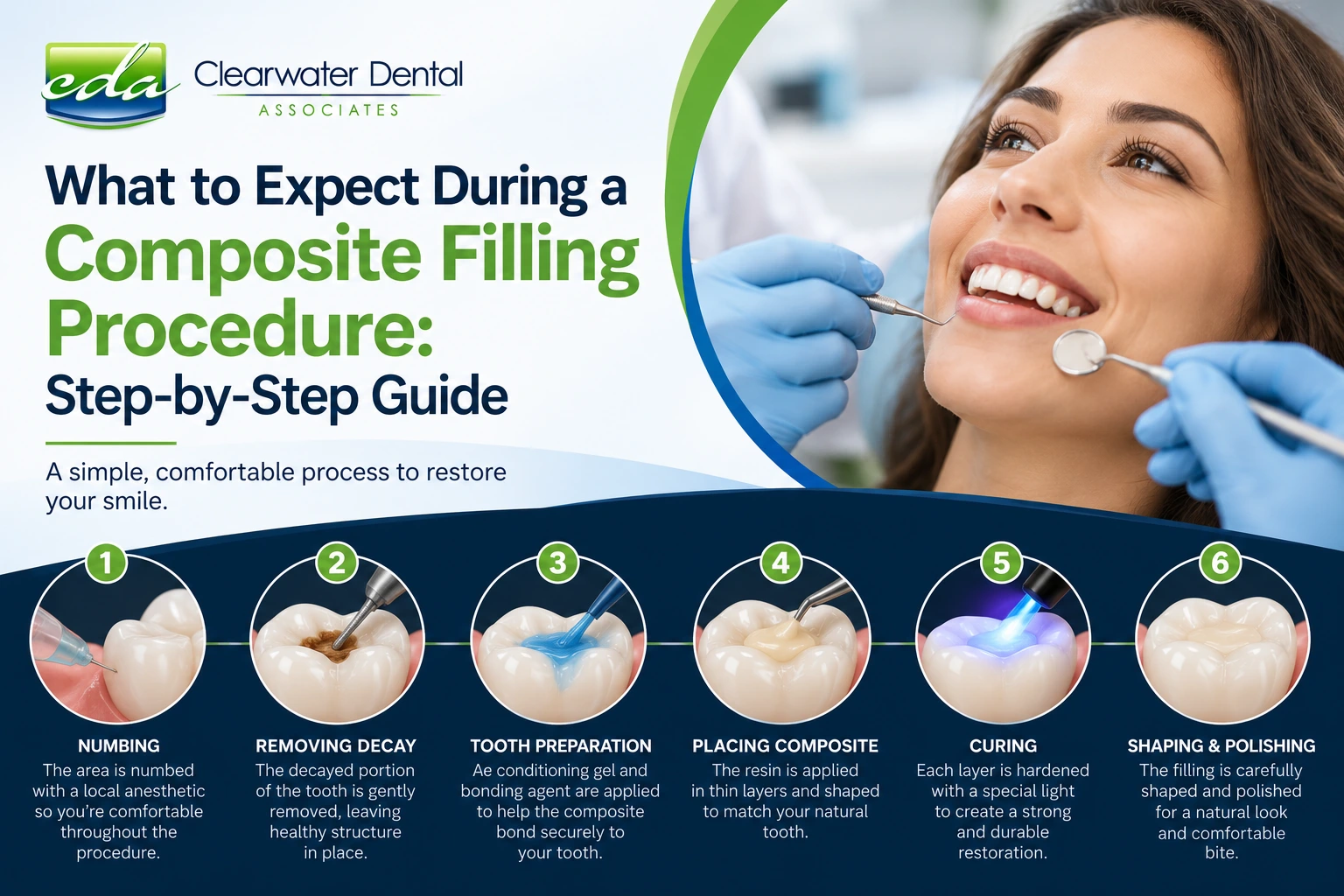 composite filling guide