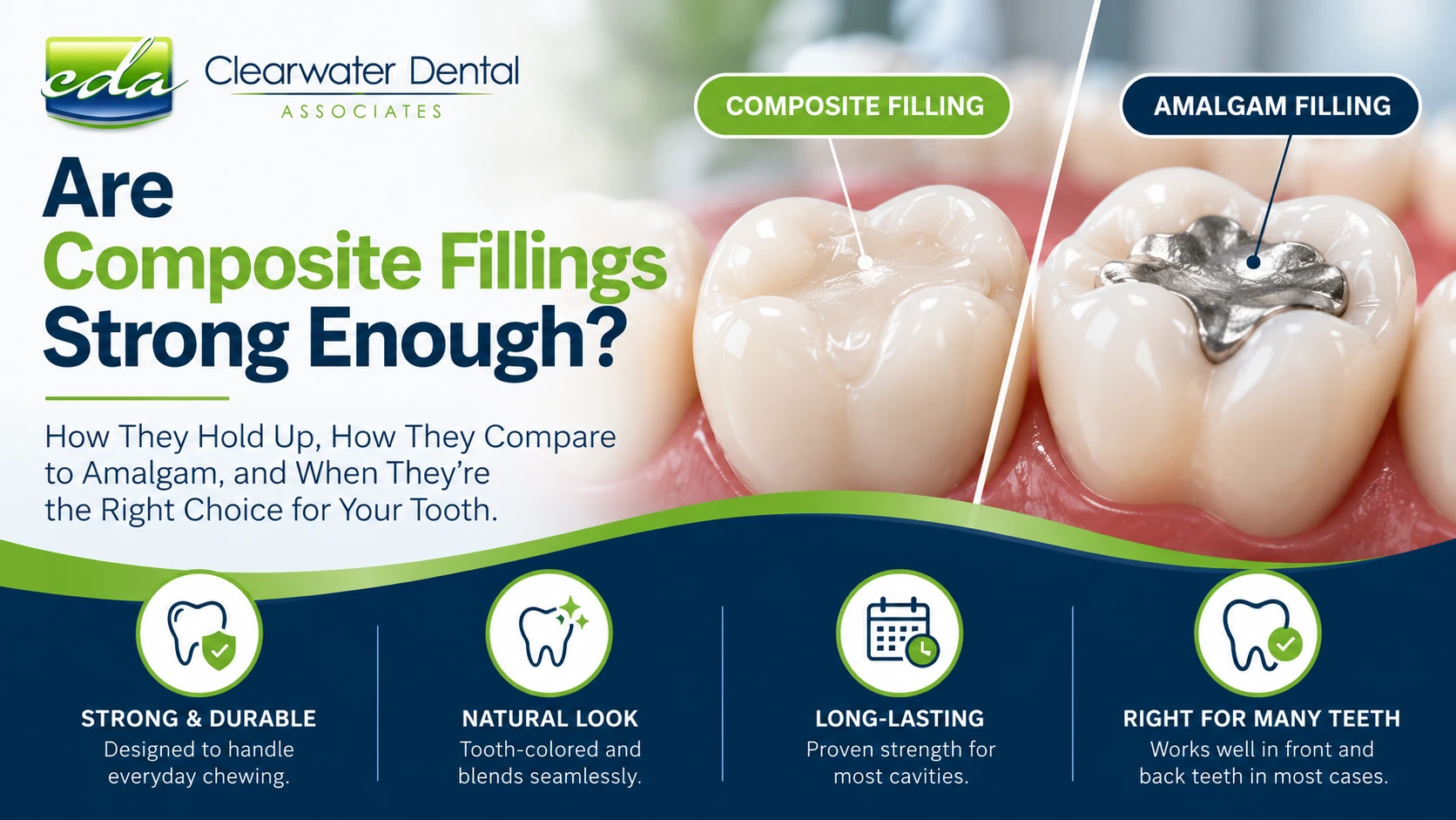 Composite vs. amalgam dental fillings showing tooth-colored and silver fillings at Clearwater Dental Associates.